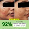 Dot and Key cica and 2 salicylic skin clearing face serum - Image 3